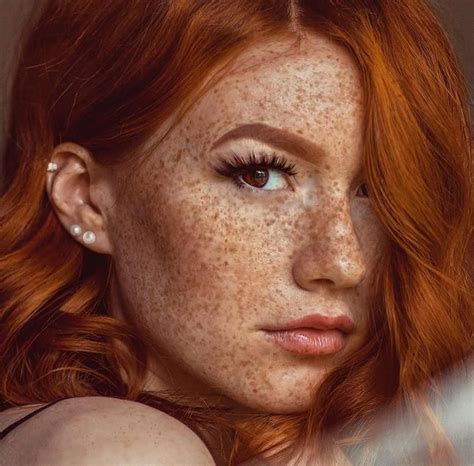 nude freckles|Fetish: Freckles